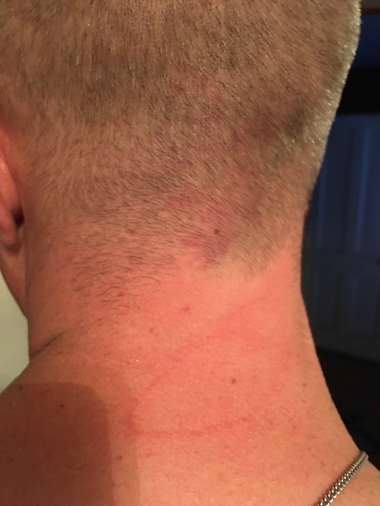 Archival LiveSciFi photograph documenting marks on Tim Wood's neck during a reported ZoZo-related investigation